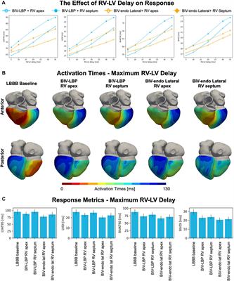 Leadless biventricular left bundle and endocardial lateral wall pacing versus left bundle only pacing in left bundle branch block patients